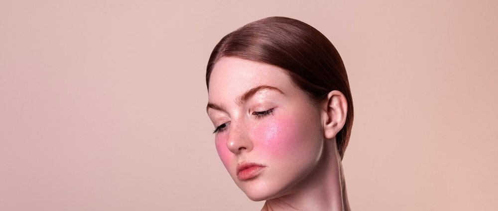 Rosacée : identifier les déclencheurs pour limiter les poussées