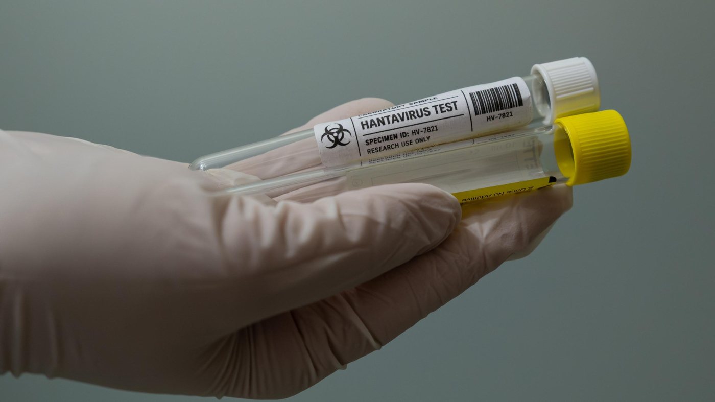 Hantavirus: un touriste ayant transité en France en juillet a été déclaré positif et isolé en Espagne, annonce le ministère de la santé